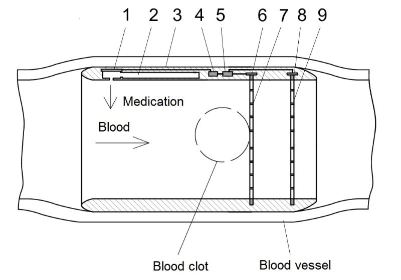 Modellzeichnung des Thromb-Guard. Foto - Stefan Velja