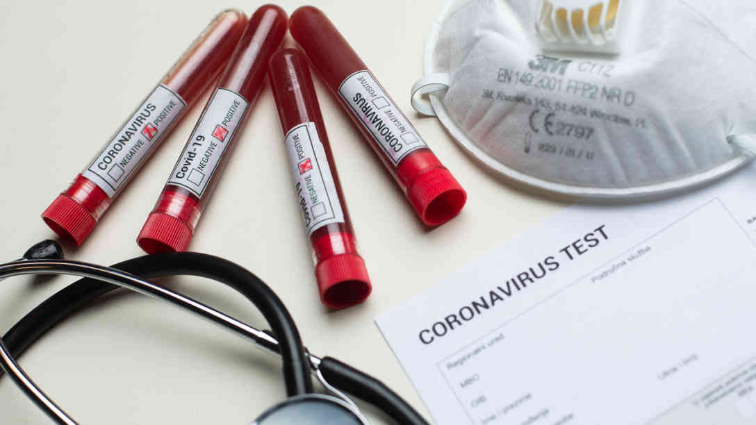 In vielen Ländern werden weitreichende Vorkehrungen getroffen, um die Verbreitungsgeschwindigkeit des Coronavirus zu verlangsamen. Foto: picture alliance | PIXSELL